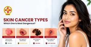 Skin Cancer Types