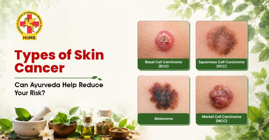 Skin Can Types Types of Skin Cancer: Can Ayurveda Help Reduce Your Risk? - Mumbai-Andheri