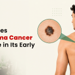 What Does Melanoma Cancer Look Like in Its Early Stages?