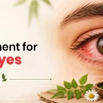 What Is the Best Treatment for Red Eyes?