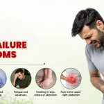 7 Early Liver Failure Symptoms You Should Know