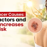 Skin Cancer Causes: Risk Factors and What Increases Your Risk