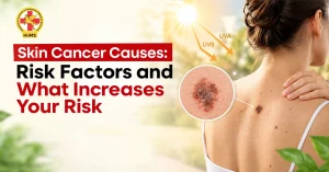 Skin-Cancer-Causes-