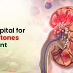 Kidney Stones Treatment