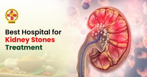 Kidney Stones Treatment