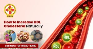 How to Increase HDL Cholesterol