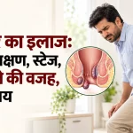 बवासीर का इलाज: कारण, लक्षण, स्टेज, खून आने की वजह, घरेलू उपाय