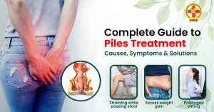 Complete Guide to Piles Treatment Causes, Symptoms & Solutions