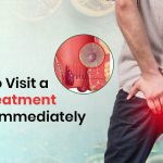 When to Visit a Piles Treatment Doctor Immediately