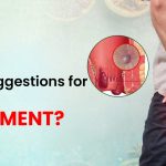 How to Treat Piles: Causes, Symptoms & Best Treatment Options