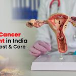 Cervical Cancer Treatment in India: Options, Cost & Care