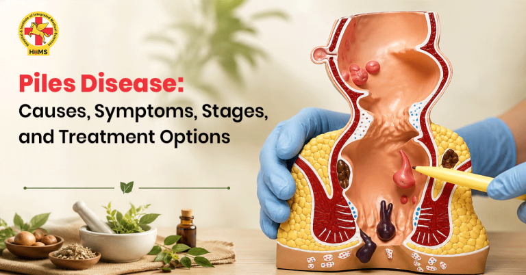 Piles-Disease-Causes,-Symptoms,-Stages,-and-Treatment-Options