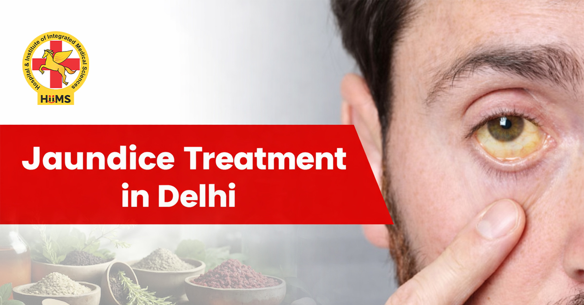 jaundice treatment in delhi