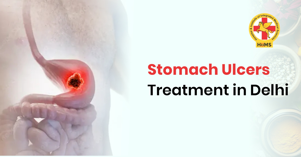 stomach ulcers treatment in Delhi