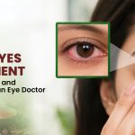 Itchy Eyes Treatment: Best Medicine and When to See an Eye Doctor