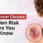 Skin Cancer Causes: 7 Hidden Risk Factors You Must Know