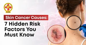7 skin cancer causes