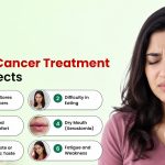 Mouth Cancer Treatment Side Effects and How to Manage Them