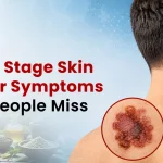 7 Early-Stage Skin Cancer Symptoms Most People Miss