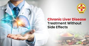 Chronic Liver Disease Treatment Without Side Effects