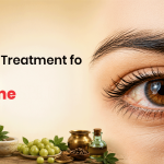 Ayurvedic Treatment for Dry Eye Syndrome: Diet, Lifestyle, and Eye Care