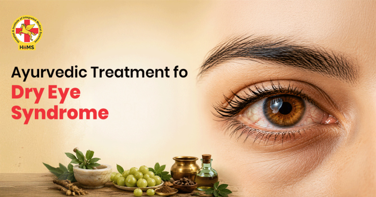 dry eyes syndrome treatment in ayurveda