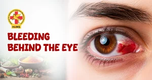 Bleeding Behind the Eye