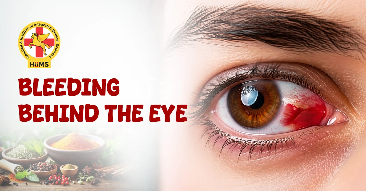 Bleeding Behind the Eye