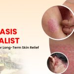 Psoriasis Specialist