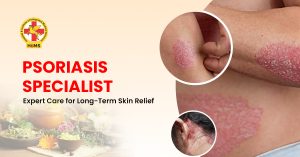Psoriasis Specialist