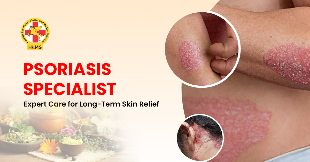 Psoriasis Specialist