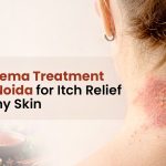 Best Eczema Treatment in New Noida for Itch Relief & Healthy Skin