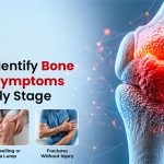 How to Identify Bone Cancer Symptoms at an Early Stage