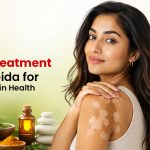 Vitiligo Treatment in New Noida for Long-Term Skin Health