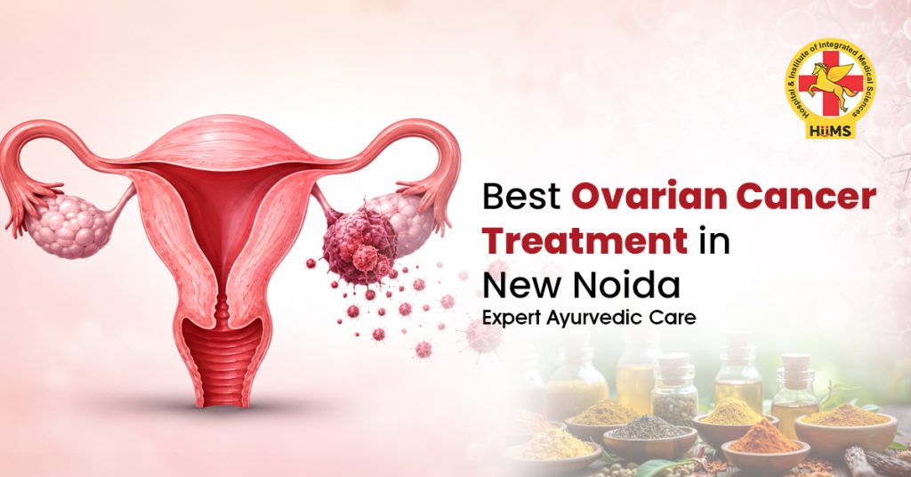 Ovarian Cancer Treatment