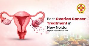 Ovarian Cancer Treatment