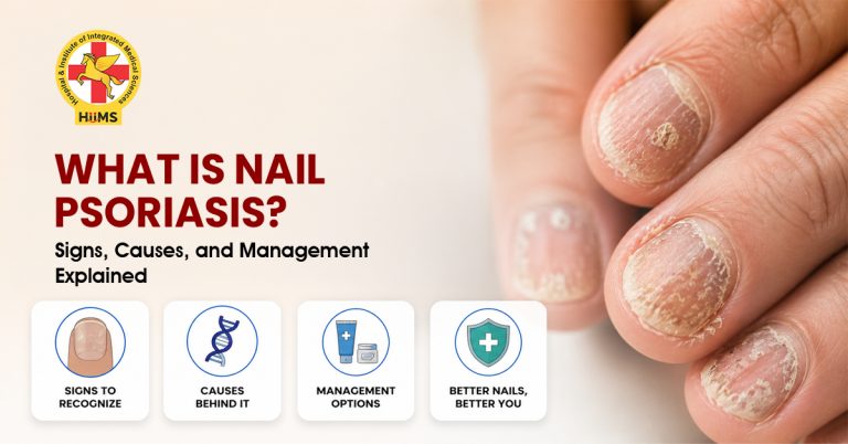 What Is Nail Psoriasis Signs, Causes, and Management Explained