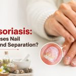 Nail Psoriasis: What Causes Nail Damage and Separation?