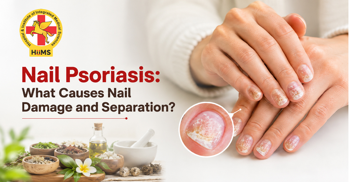 Nail Psoriasis What Causes Nail Damage and Separation