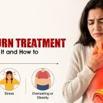 Heartburn Treatment: What Causes It and How to Manage It