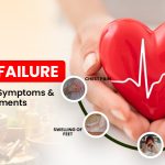 Heart Failure : Causes, Early Symptoms, and Effective Treatment Options
