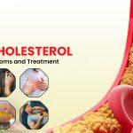 Cholesterol causes