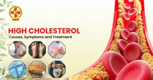Cholesterol causes