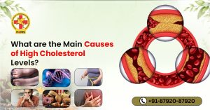 Causes of High Cholesterol