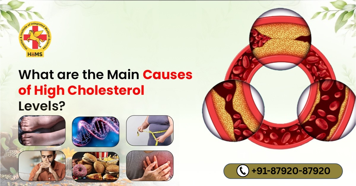 Causes of High Cholesterol
