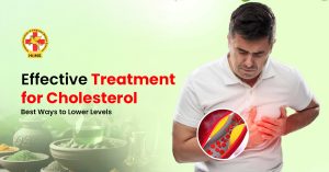 treatment for cholesterol