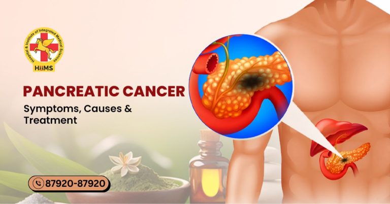 pancreatic cancer causes