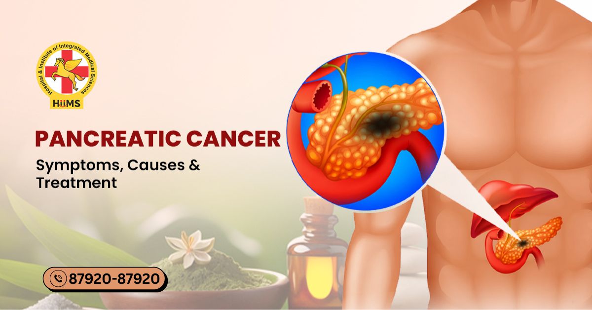 pancreatic cancer causes