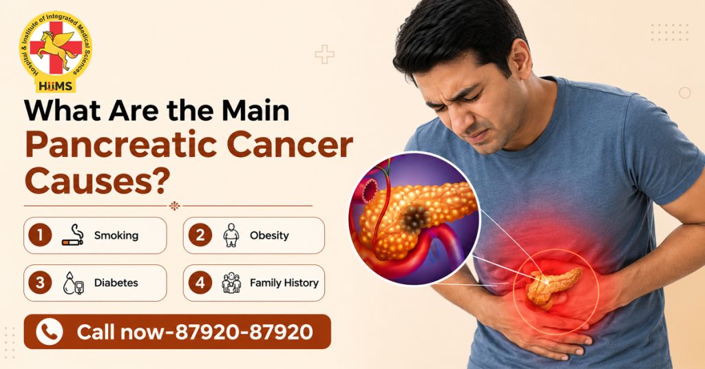 Pancreatic Cancer Causes.