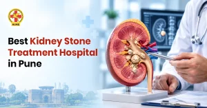 kidney stone treatment in pune